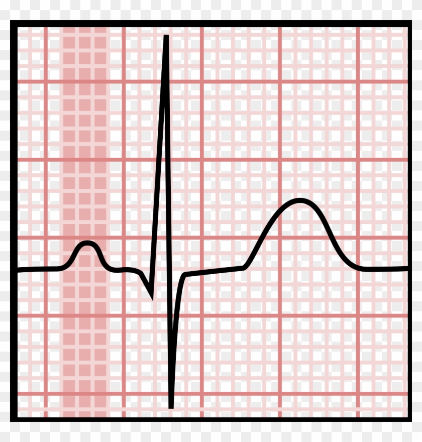 p wave normal p wave in ecg hd png download 1200x1200 p wave ecg