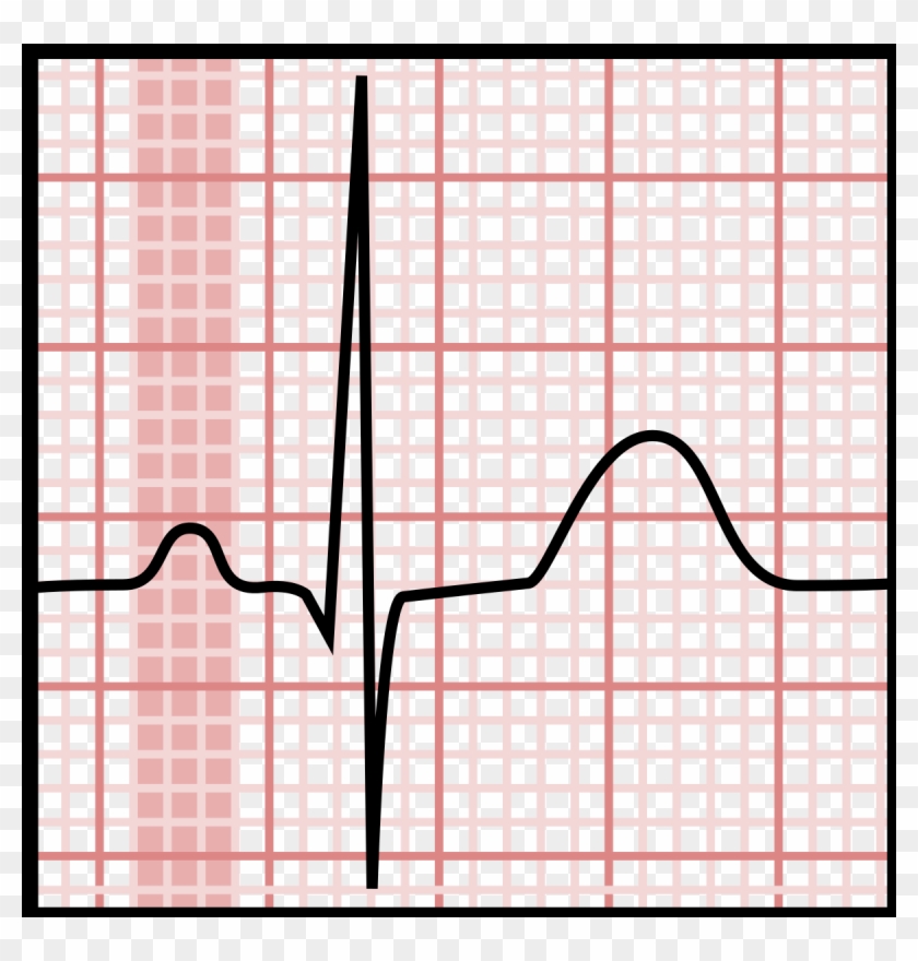 P Wave - Normal P Wave In Ecg, HD Png Download - 1200x1200(#1493898