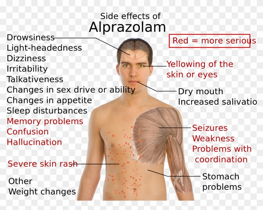 Effects of alprazolam side what are