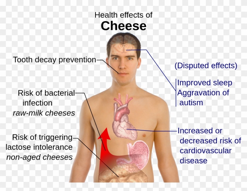 Health Effects Of Cheese Disadvantages Of Cheese, HD Png Download