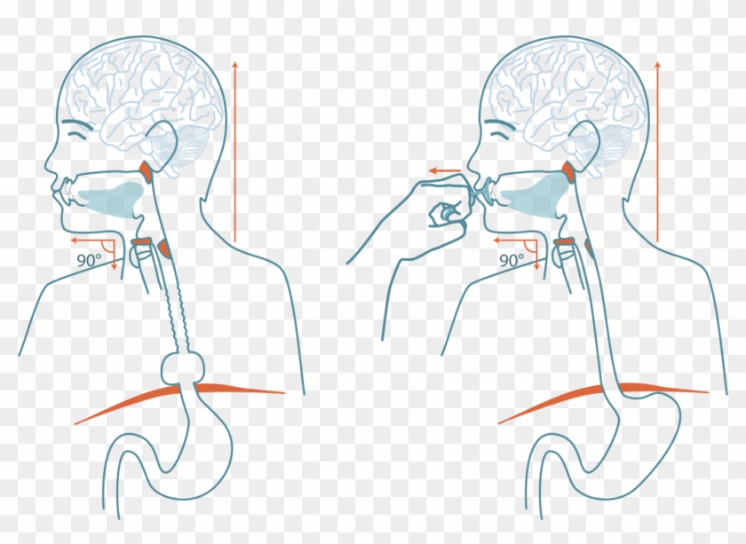 See How The Upper Esophagus Sphincter Does Not Open Cartoon Hd Png Download 1024x699 Pngfind See How The Upper Esophagus Sphincter Does Not Open Cartoon Hd Png Download 1024x699 Pngfind
