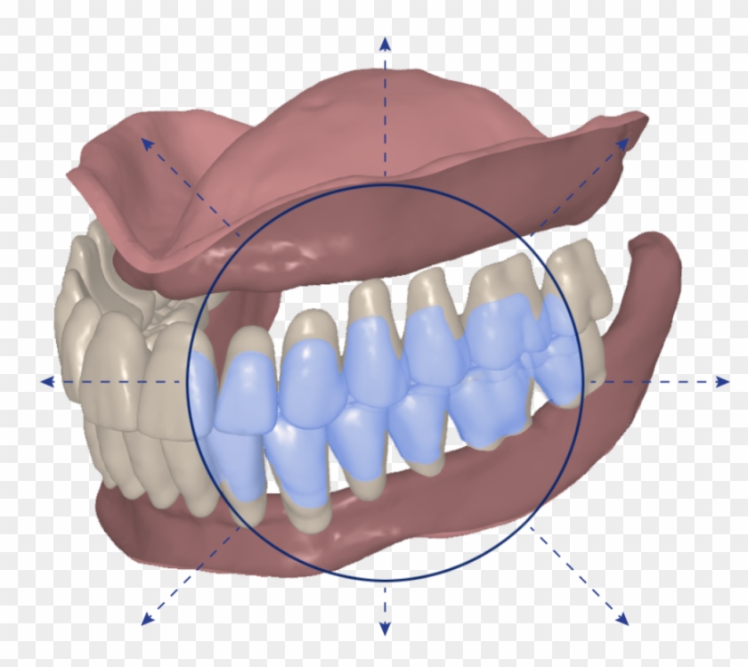 Avadent Signature Digital Dentures Dental Solutions, HD Png Download ...