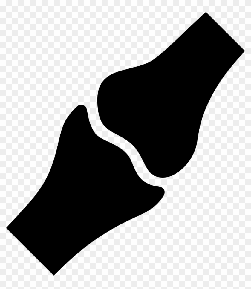 Download Png File Svg Bone Joint Vector Transparent Png 888x980 488438 Pngfind