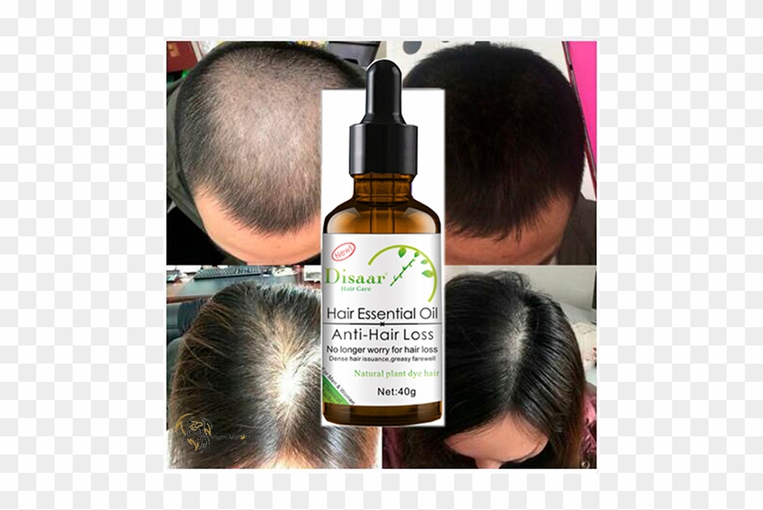 Repairs Follicles And Boosts Hair Growth Hair Growth Natural