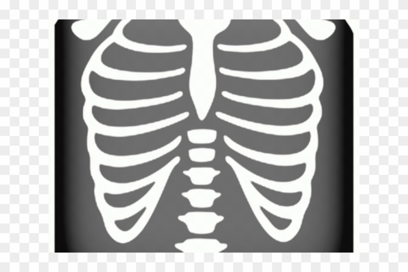 Chest X Ray Cartoon, HD Png Download - 640x480(#5612649) - PngFind
