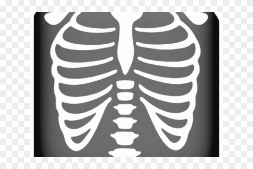 Chest X Ray Cartoon Hd Png Download 640x480 5612649 Pngfind Xray cartoon 11 of 11. chest x ray cartoon hd png download