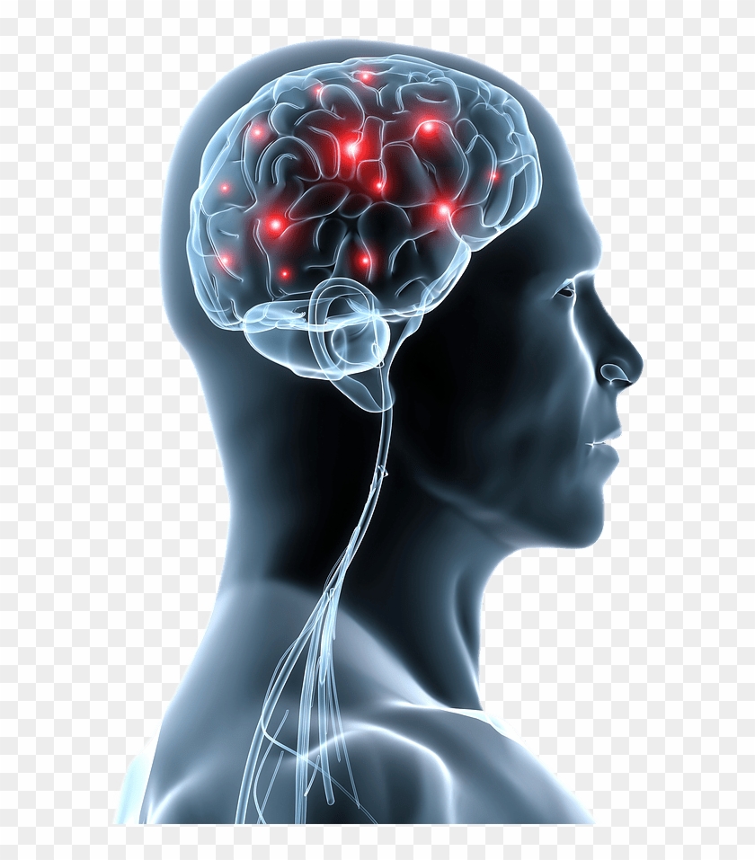 Is Stress A Matter Of Perspective - Neurologic Problem, HD Png Download - 6...