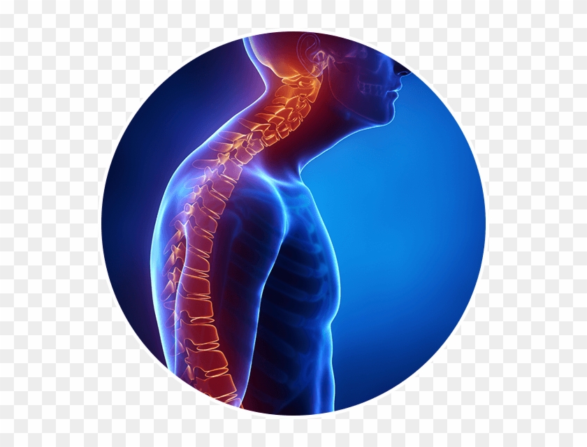 This Abnormal Curvature Of The Spine Can Cause Spinal Postural