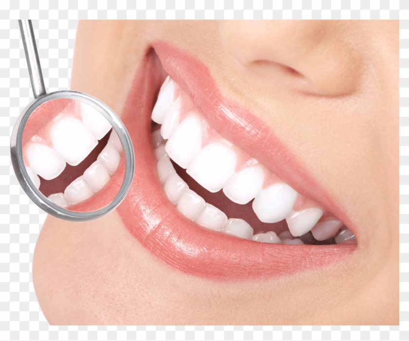 Dental Veneers - Smile Dental Png, Transparent Png - 2658x1835(#6433231