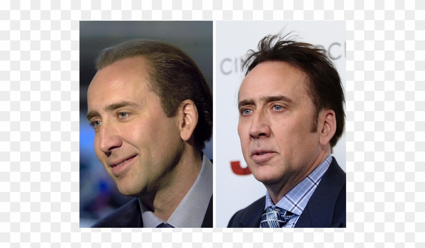 Nicolas Cage, 2001 Vs - Celebrity Hair Fibers, HD Png Download.
